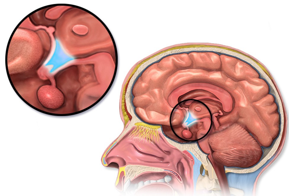 A side-on cutaway of the head with a magnified inset of the hypothalamus, a small region deep at the base of the brain, sitting just above the pituitary gland.
