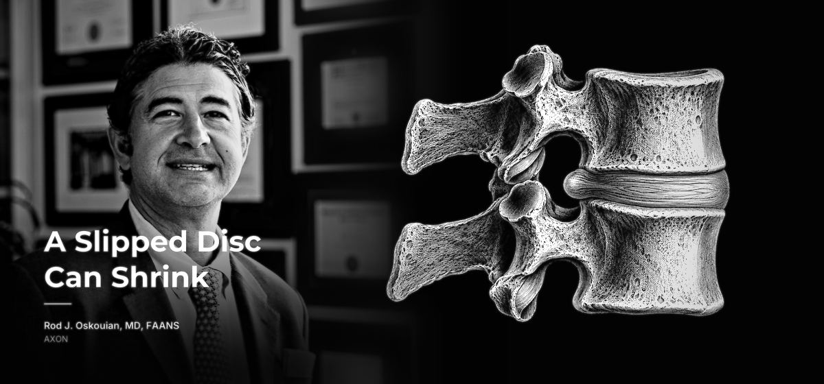 Dr. Rod Oskouian beside an engraved pair of lumbar vertebrae with one small bulge in the disc between them. AXON, by Rod J. Oskouian, MD, FAANS